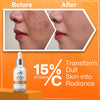 15% Vitamin C Face Serum with 0.5% Ferulic Acid for Glowing Skin, 30 ml